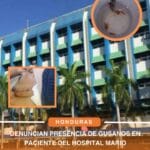 Denuncian presencia de gusanos en paciente del Hospital Mario Catarino Rivas