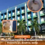 Denuncian presencia de gusanos en paciente del Hospital Mario Catarino Rivas