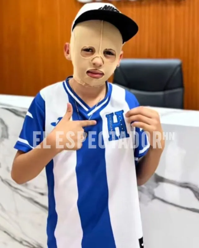EDWARD DANIEL, EL PEQUEÑO HÉROE QUE LLEVARÁ SU SONRISA AL PARTIDO ENTRE HONDURAS Y NICARAGUA