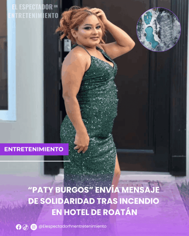 “Paty Burgos” envía mensaje de solidaridad tras incendio en Hotel de Roatán