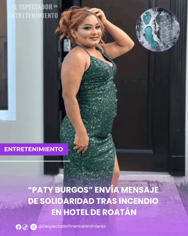 “Paty Burgos” envía mensaje de solidaridad tras incendio en Hotel de Roatán