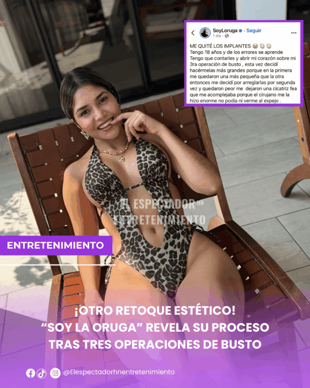 Soy la oruga revela su proceso tras tres operaciones de busto