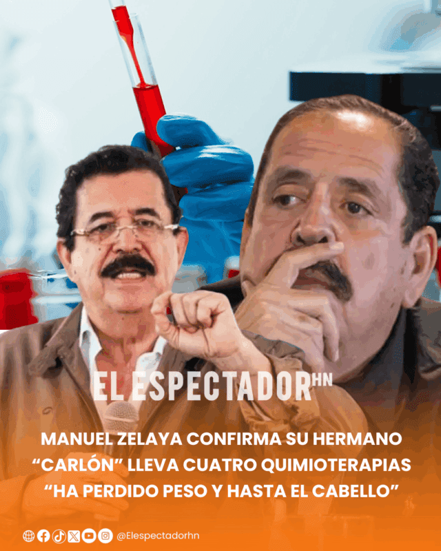 Manuel Zelaya confirma su hermano “Carlón” lleva cuatro quimioterapias “ha perdido peso y hasta el cabello”