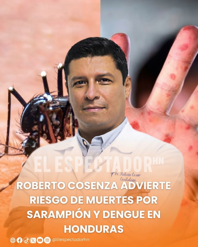 Sarampión y dengue requieren vacunación para prevenir muertes en Honduras según Cosenza.