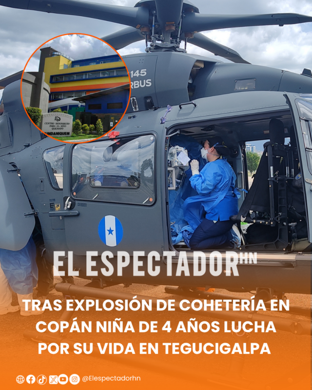 Tras explosión de cohetería en Copán niña de 4 años lucha por su vida en Tegucigalpa