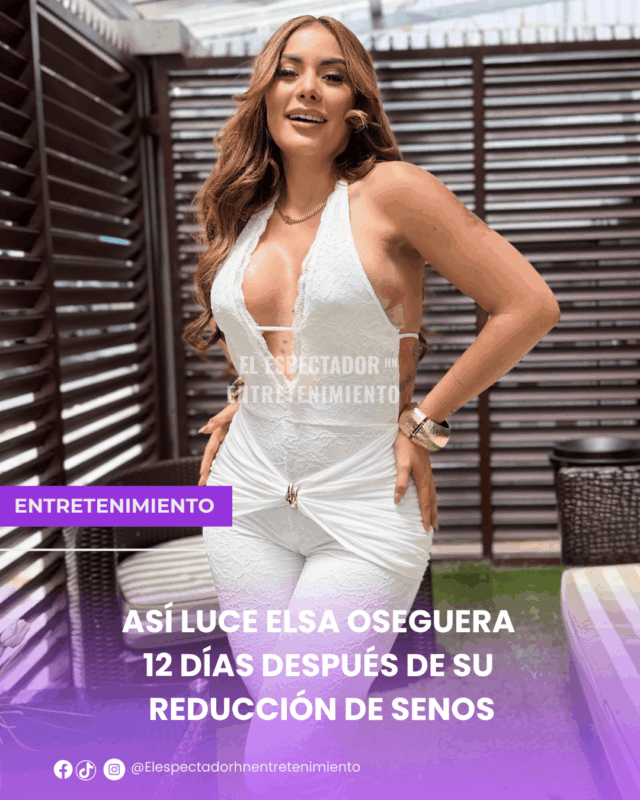 Así luce Elsa Oseguera 12 días después de su reducción de senos